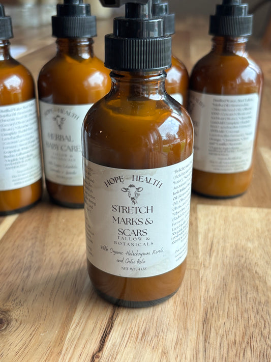 NEW Stretch Mark & Scar Lotion