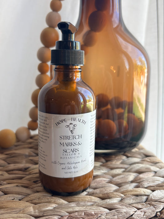 NEW Stretch Mark & Scar Lotion
